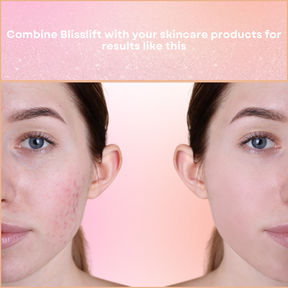 BlissLift