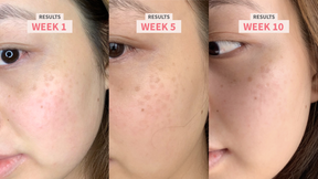 BlissGleam | Facial Cleansing Brush & LED Light therapy